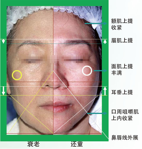 mg冰球突破豪华版(试玩)官方网站