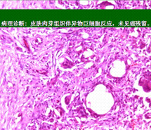 mg冰球突破豪华版(试玩)官方网站