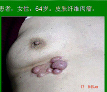 mg冰球突破豪华版(试玩)官方网站