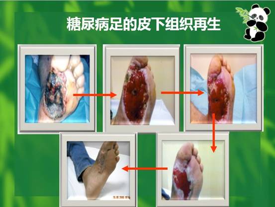 mg冰球突破豪华版(试玩)官方网站
