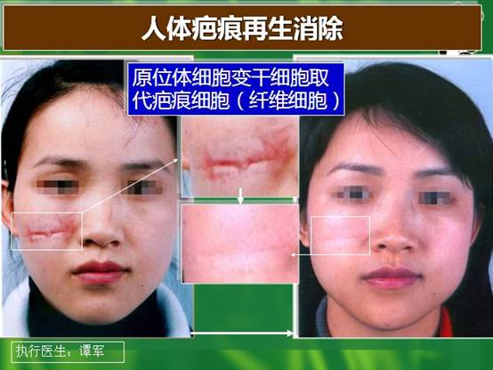 mg冰球突破豪华版(试玩)官方网站