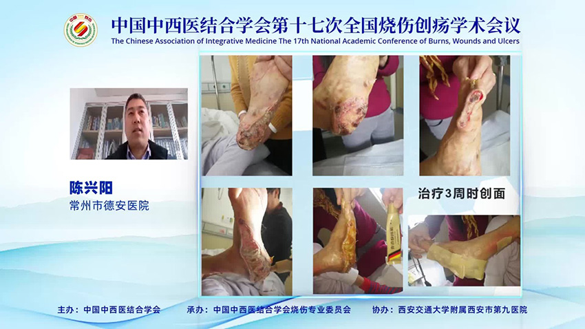 mg冰球突破豪华版(试玩)官方网站