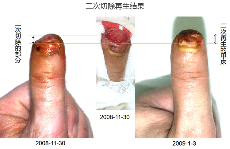 mg冰球突破豪华版(试玩)官方网站