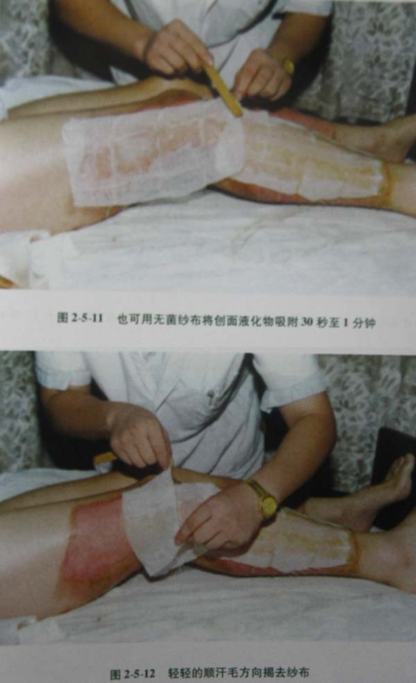 201131142449855