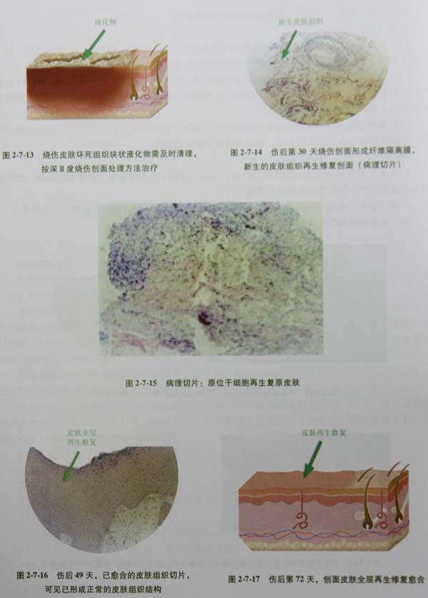 201131155722226