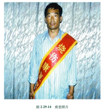 20113314657350